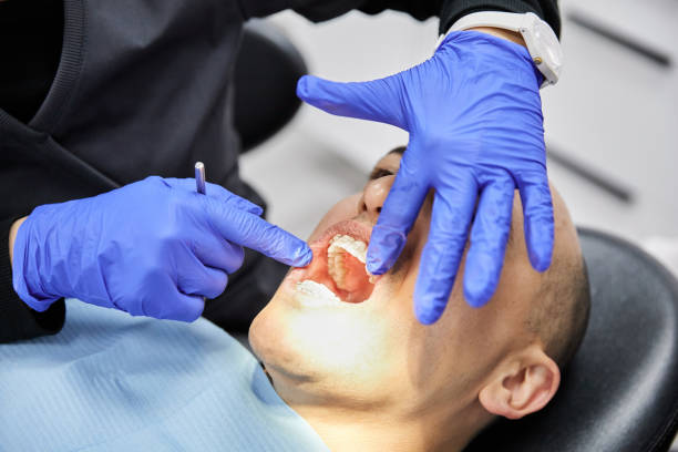 Best Emergency Treatment for Dental Infections or Abscesses in Pismo Beach, CA